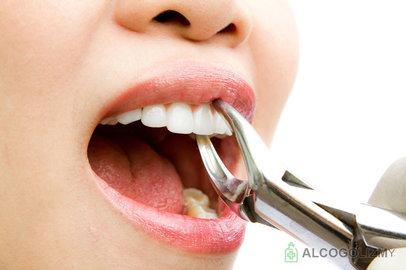 Можно пить алкоголь после лечения зуба